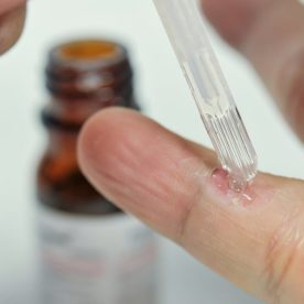 Someone applying wart remover to their finger.