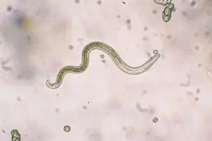 A microscopic parasite, Toxocara sp.