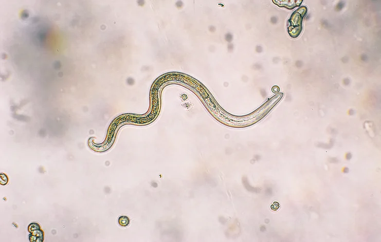 A microscopic parasite, Toxocara sp.