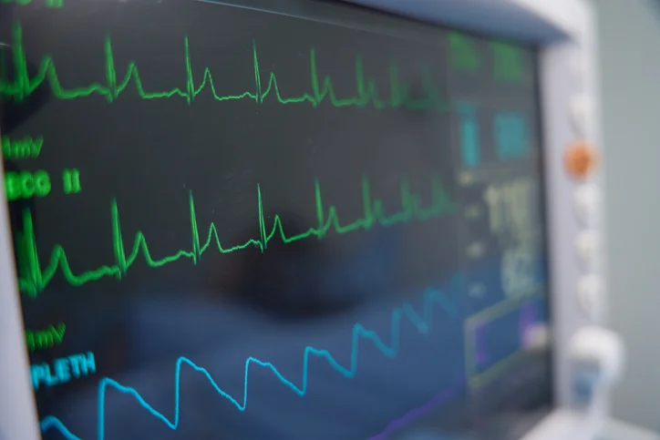 A heart rate monitor showing the patient's readings.